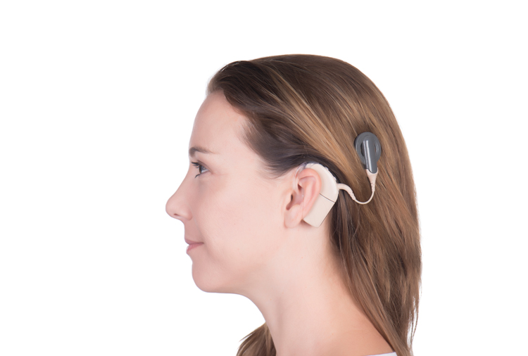 Cochlear implant