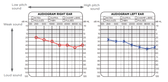 audiogram right left